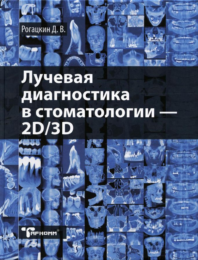 Лучевая диагностика в стоматологии: 2D/3D: Учебное пособие : Рогацкин Д ...